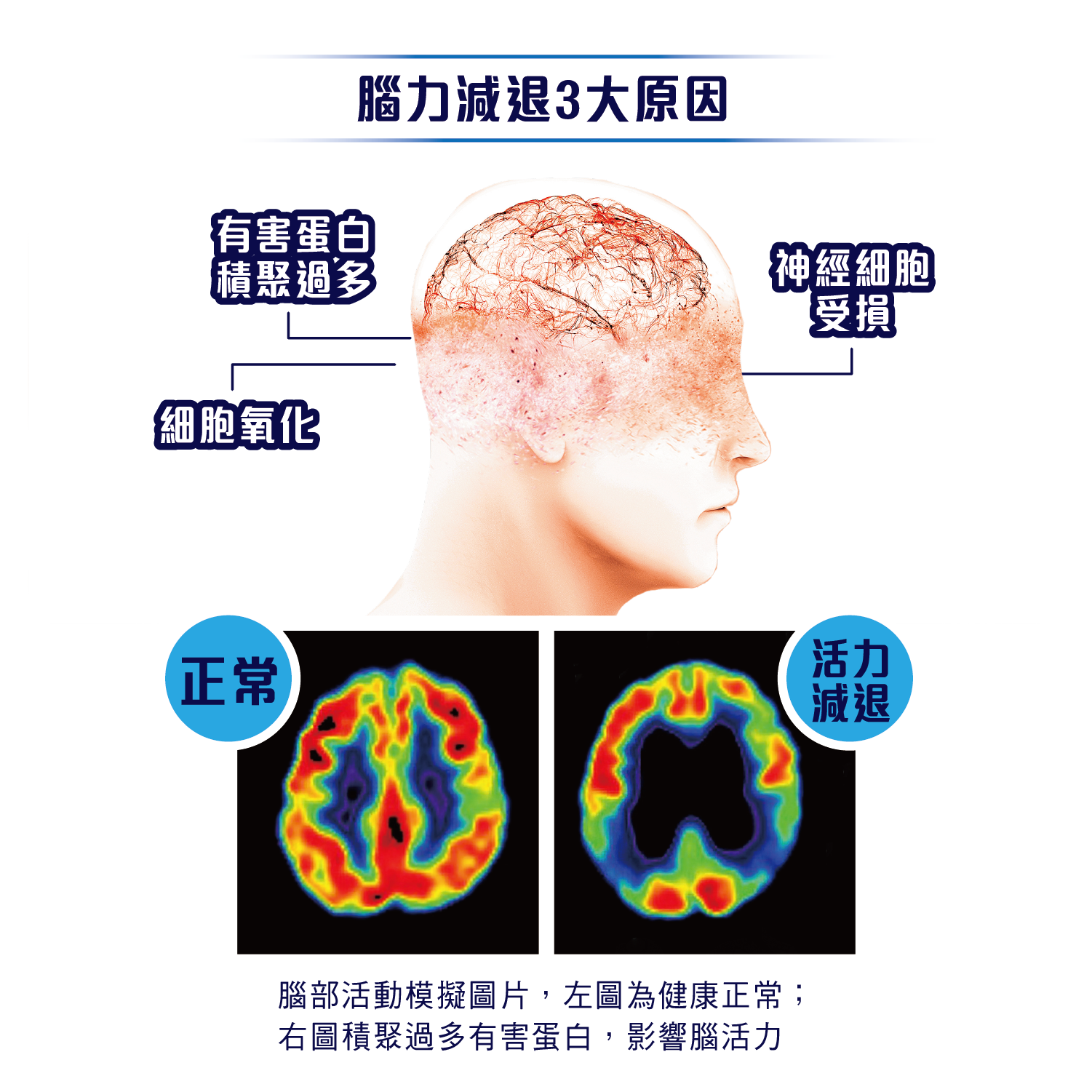 維特健靈腦精靈